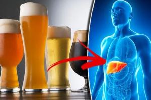 3 loại nước có khả năng ‘giết’ lá gan, hại chẳng kém rượu bia: Nhiều người vẫn uống mỗi ngày